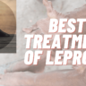 Leprosy Disease Can Be Fatal For You Don't Ignore It And Treat Fast