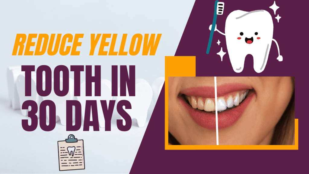 16 Superior Ways To Reduce Yellowness Teeth In Just 30 Days