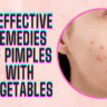 7 Effective Remedies Of Pimples With Vegetables