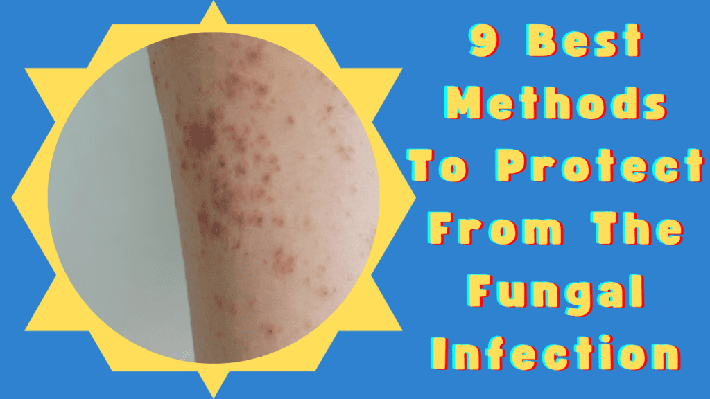 Fungal Infection 9 Best Methods To Protect From The Fungal Infection