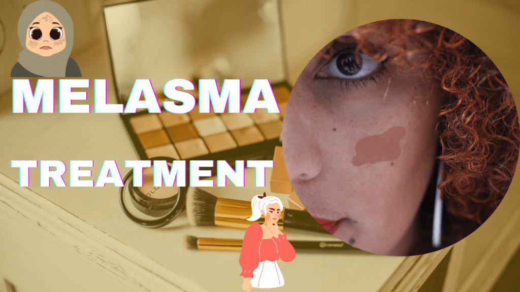 This Treatment Of Melasma Will Remove Your Spots In 1 Month