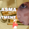 This Treatment Of Melasma Will Remove Your Spots In 1 Month