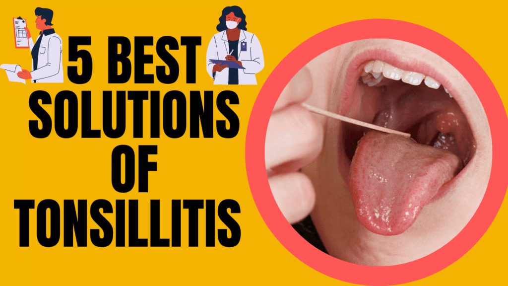Tonsillitis 5 Best Solution, Preventions And Reasons