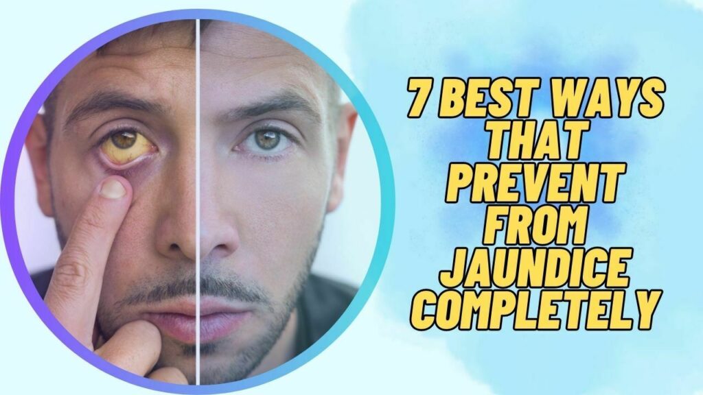 7 Best Ways That Prevent From Jaundice Completely
