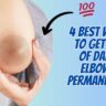 4 Best Ways To Get Rid Of Dark Elbows Permanently