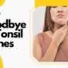 Say Goodbye to Tonsil Stones: 3 Expert Solutions for a Cleaner, Healthier Mouth